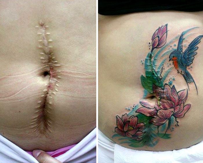 mastectomía-abuso-cicatriz-mujeres-tatuaje-libre-flavia-carvalho-daedra-art-brasil-6