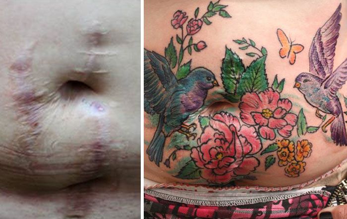 mastektomia-väärinkäyttö-arpi-naiset-vapaa-tatuointi-flavia-carvalho-daedra-art-brasil-5