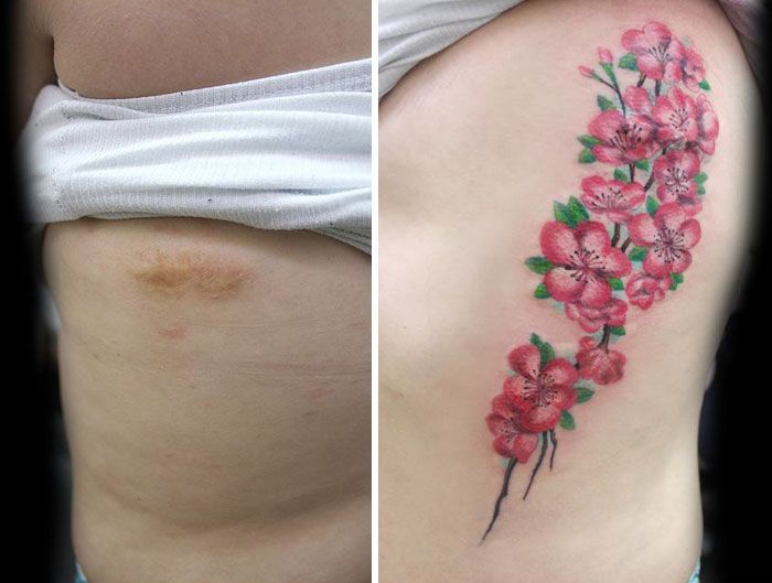 mastektomia-väärinkäyttö-arpi-naiset-vapaa-tatuointi-flavia-carvalho-daedra-art-brasil-3